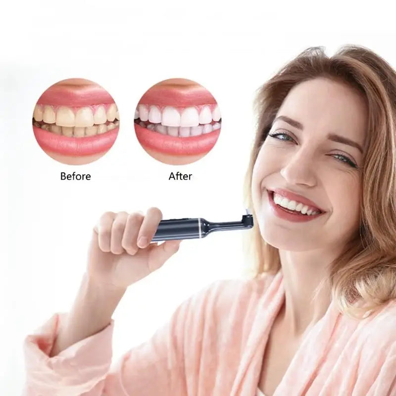 AuraSmile™ | Professional Electric Tooth Polisher & Whitening Set